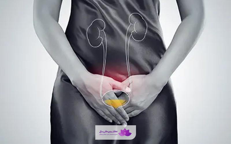 علائم و نشانه های افتادگی مثانه و درمان خانگی سیستوسل