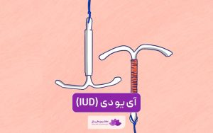 آی یو دی IUD چیست و چطور از بارداری جلوگیری میکند
