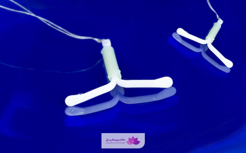 آی یو دی یا IUD چیست