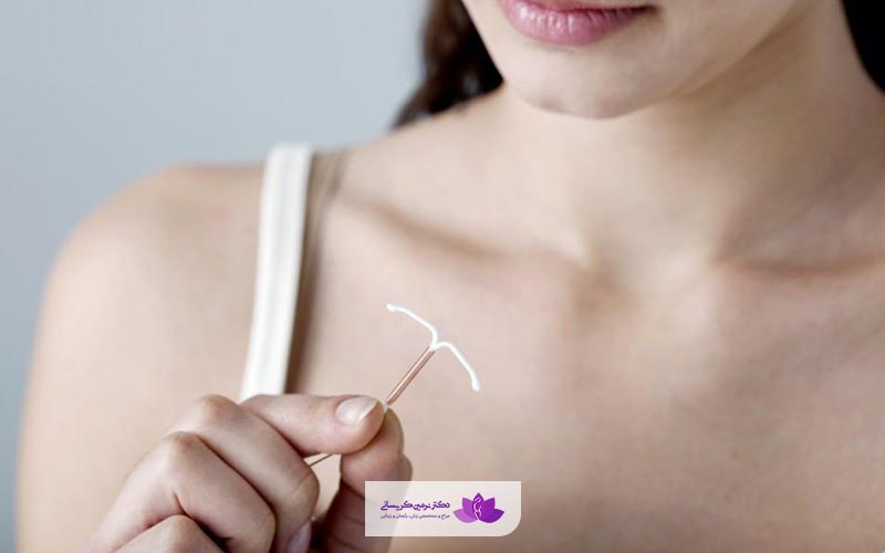 نحوه قراردادن و گذاشتن آی یو دی iud در درون رحم زنان جهت جلوگیری از بارداری