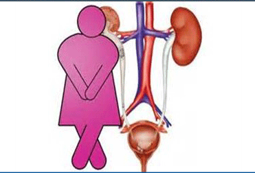 بی اختیاری اداری از عوارض عمل افتادگی مثانه