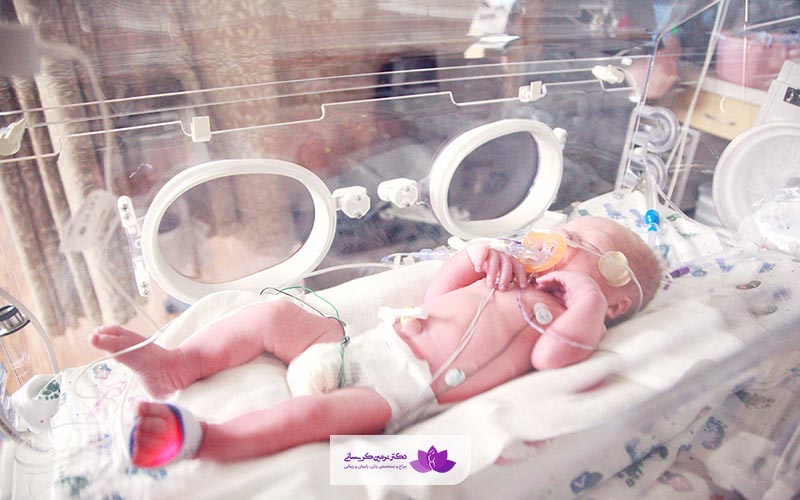 زایمان زودرس و قرارگیری بچه در دستگاه NICU