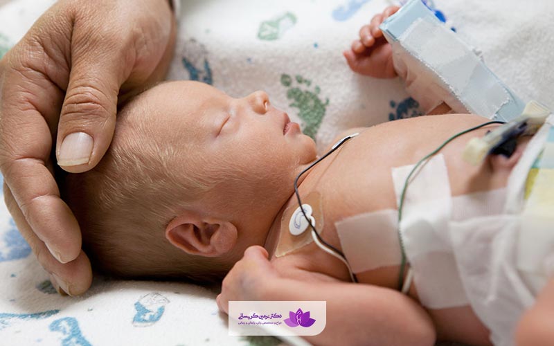 زایمان زودرس چیست؟ بررسی علائم زایمان پیش از موعد و زود هنگام