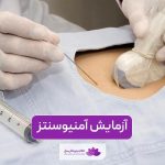 آزمایش آمنیوسنتز در بارداری زنان و نحوه تشخیص آن
