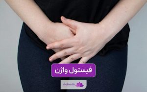 بیماری فیستول واژن چیست و چه علائمی دارد؟ روش های درمان ان