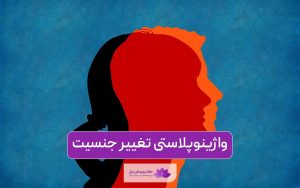 واژینوپلاستی تغییر جنسیت مرد به زن چگونه است و نکات آن