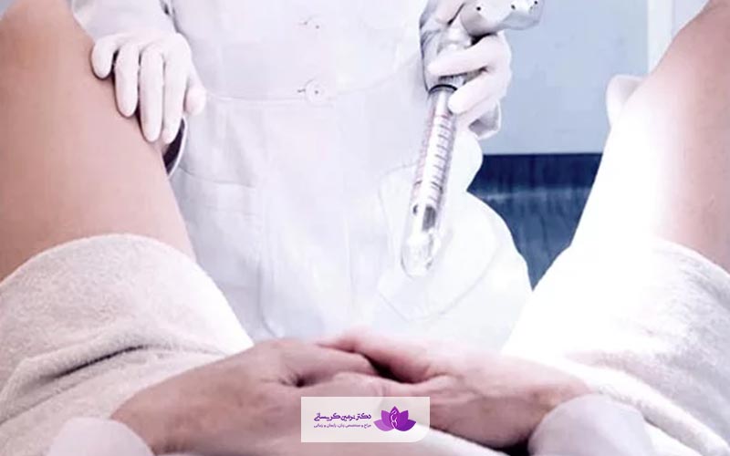 واژینوپلاستی با لیزر یا لیزر درمانی واژن چیست
