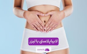 لابیاپلاستی با لیزر چگونه انجام می شود و چه مزایا و معایبی دارد؟ هزینه در سال 1404