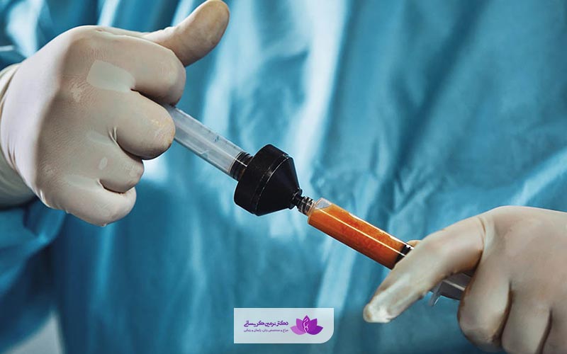 مدت ماندگاری تزریق چربی به واژن چقدر است؟