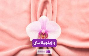واژینوپلاستی چیست و چگونه انجام میشود؟ مقایسه واژینوپلاستی با لیزر و سنتی