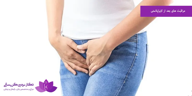 مراقبت های بعد از لابیاپلاستی