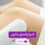 لابیاپلاستی با لیزر و مزایا و عوارض آن برای زنان و نحوه انجام لبیاپلاستی با لیزر CO2