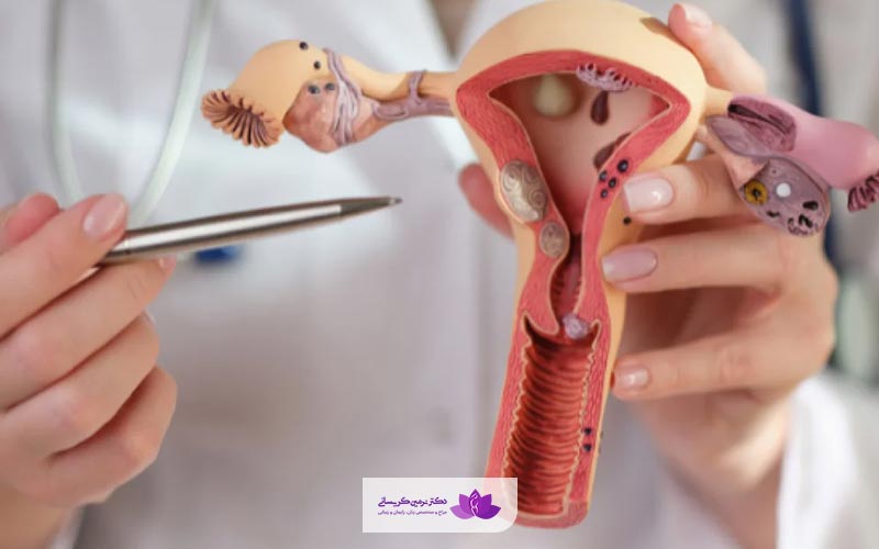 جراحی لابیاپلاستی با لیزر چگونه انجام میشود